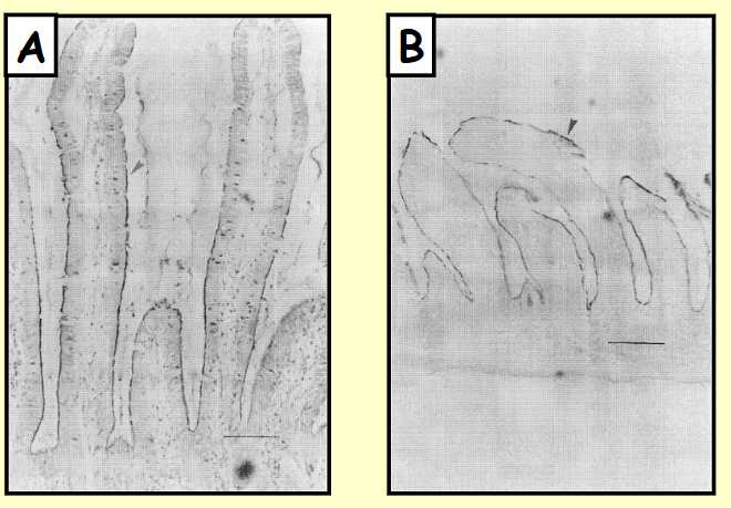 <ul><li><p>Stained with antibody that detects brush border enzyme <strong>sucrase-isomaltase </strong>(marked by arrows)</p></li><li><p>(A) <strong>active </strong>animal (B) <strong>hibernating / torpor </strong>animal</p></li></ul><p></p>
