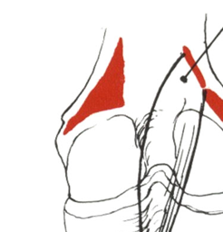 <p>Name; Insertion</p>