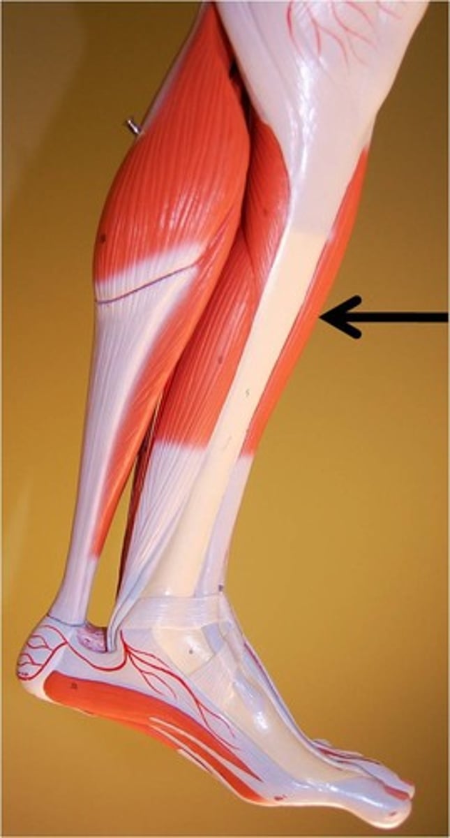 <p>Identify the indicated muscle.</p>