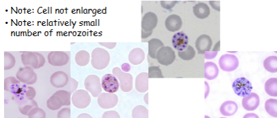 <p>What is the genus, species, and stage of this parasite?</p>