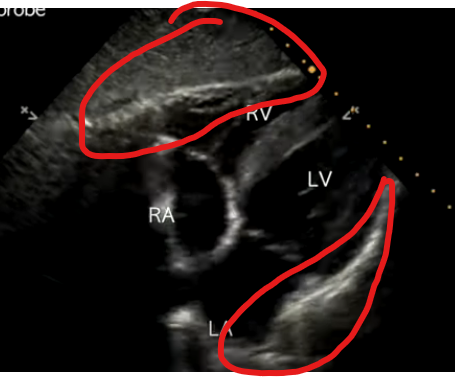 <p>What is circled</p>