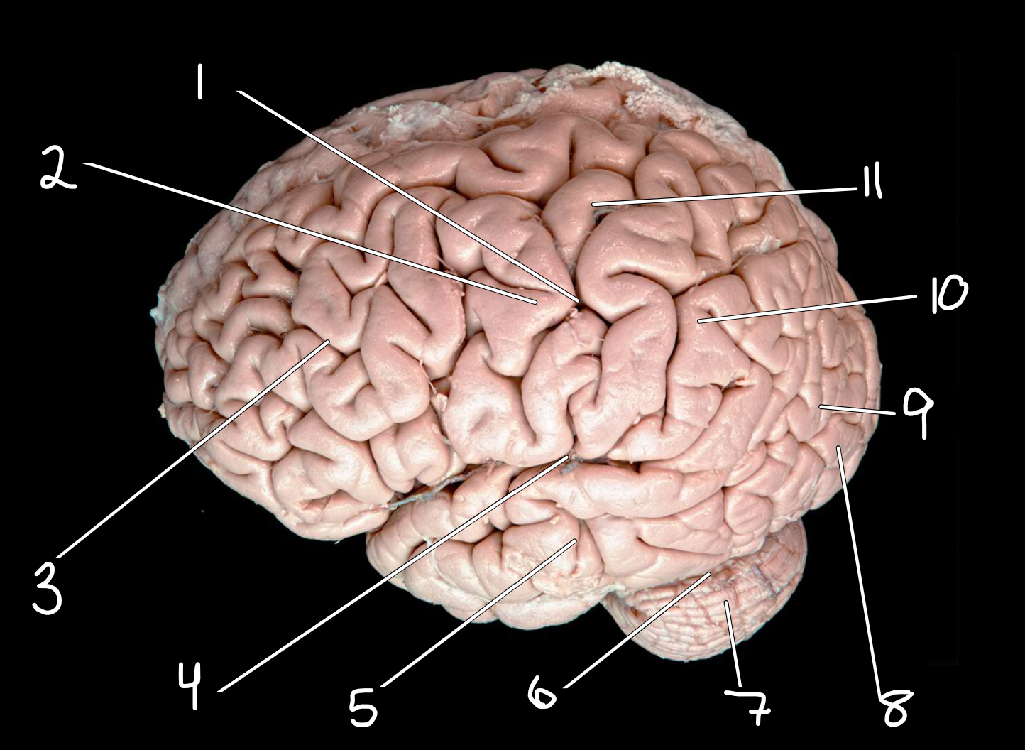 <p>Left Cerebrum and cerebellum: lateral view </p>