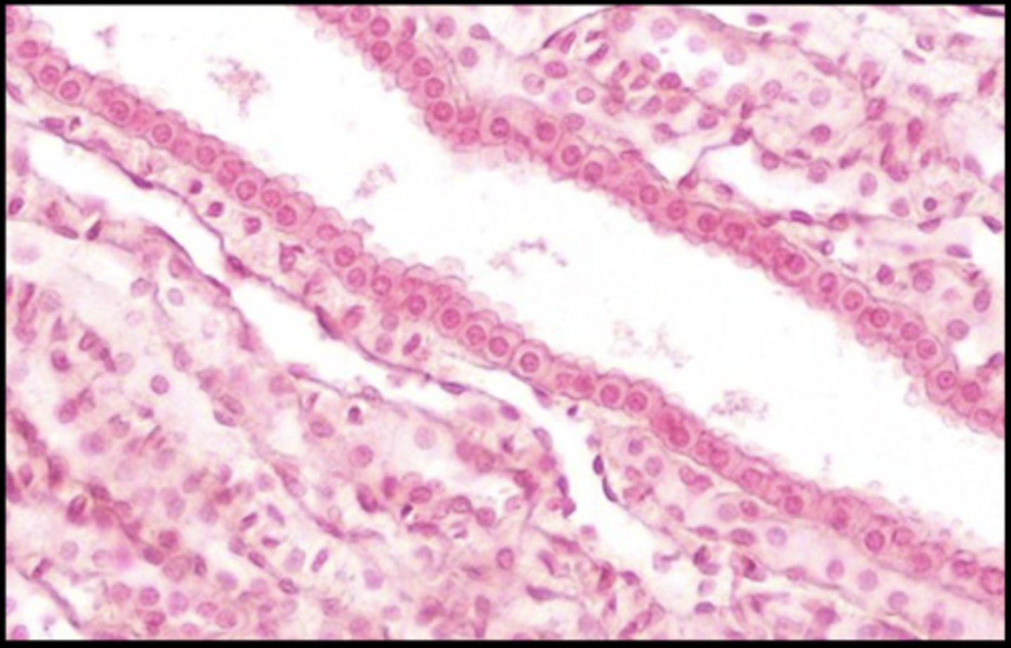 <p>Name this Tissue</p>