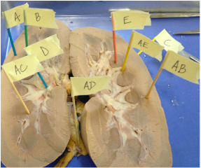 In the picture below, looking at the RIGHT side of the picture at that portion of the kidney, where is the cortex?