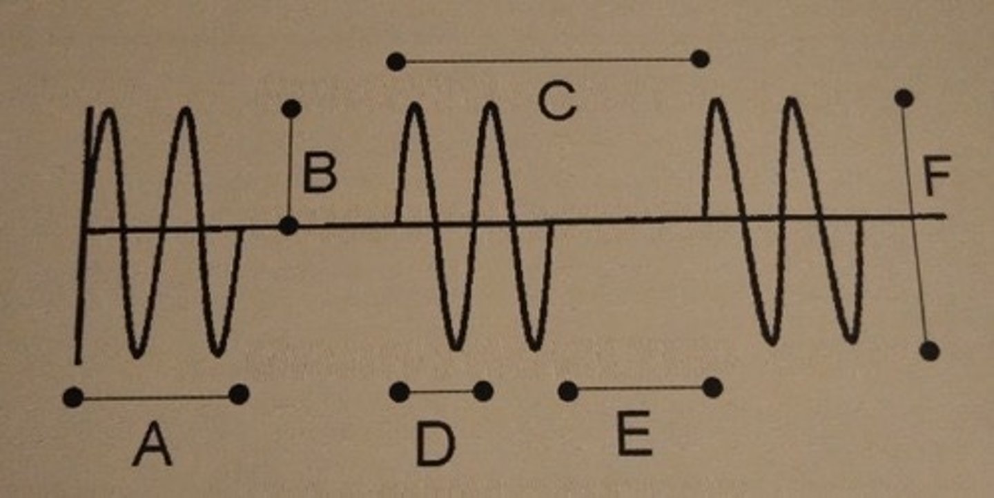 <p>F. None of the above.</p><p>Line E represents only the listening time</p>
