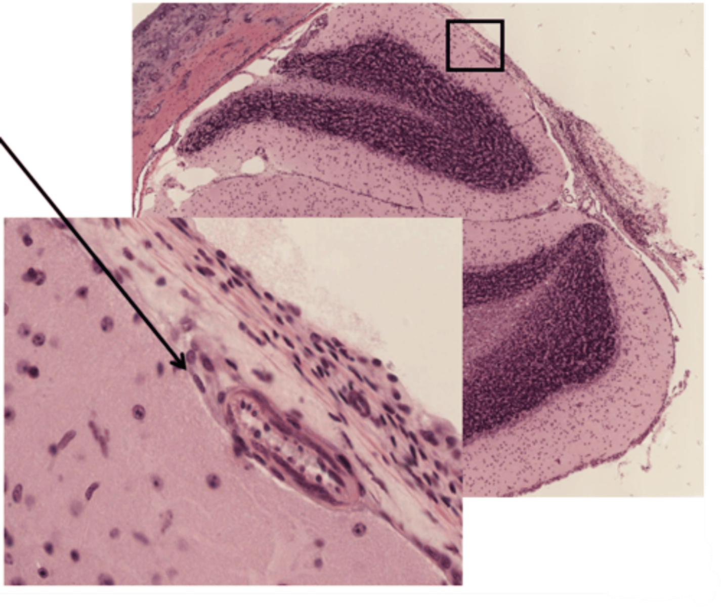 <p>Identify the layer of the cerebellum</p>