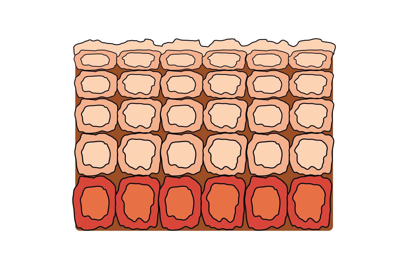 <p><span>Hyperplasia. The tissue contains a higher than usual number of cells. However, cell structure and the orderly arrangement of cells are normal.</span></p>