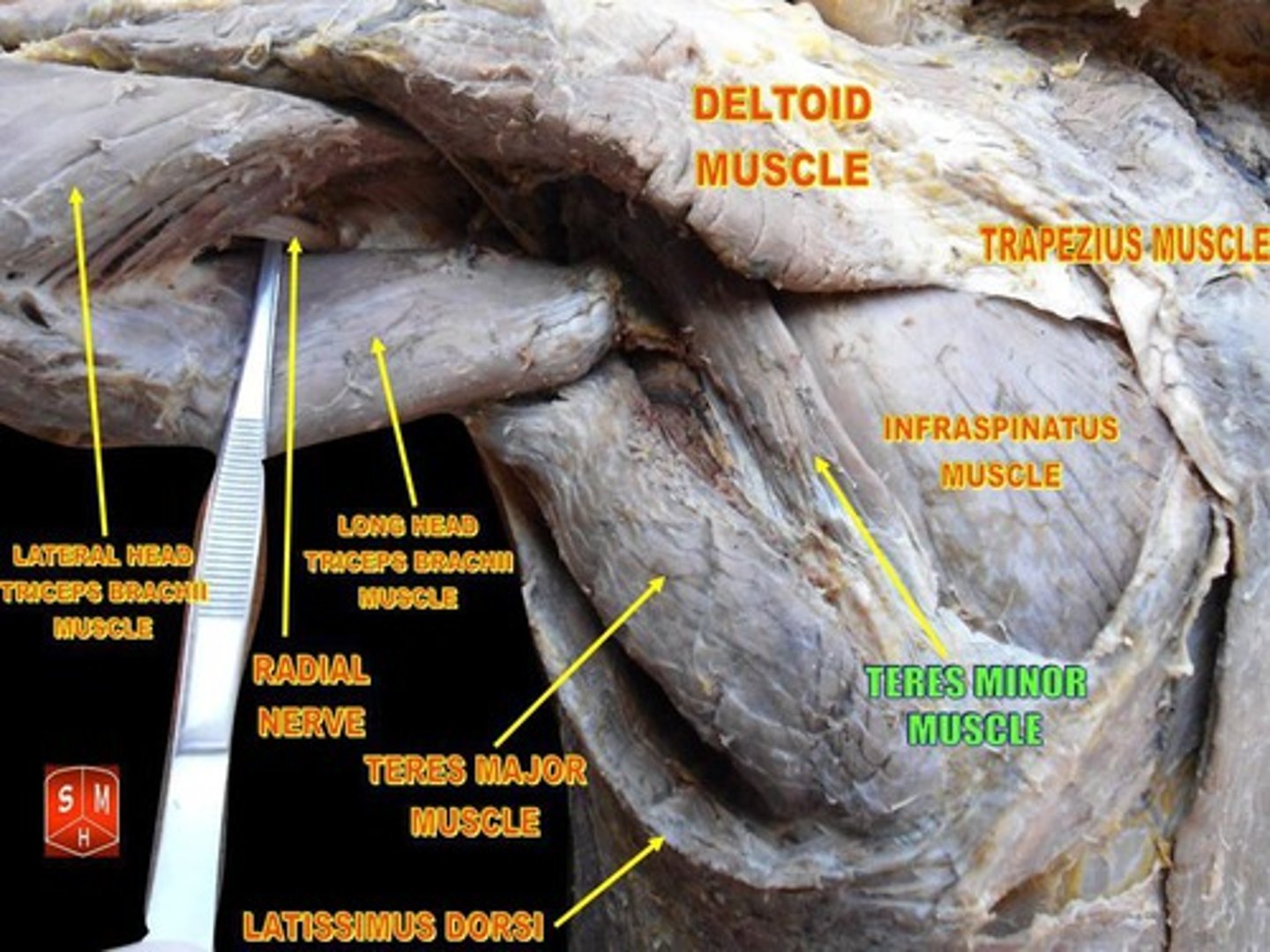 <p>In the green-Laterally rotate the shoulder (g/h joint), adduct the shoulder, extend shoulder, horizontally abduct the shoulder (g/h joint). Stabilize head of humerus in glenoid cavity; Description: Inferior to Infraspinatus, above Teres Major, scapula to humerus</p>
