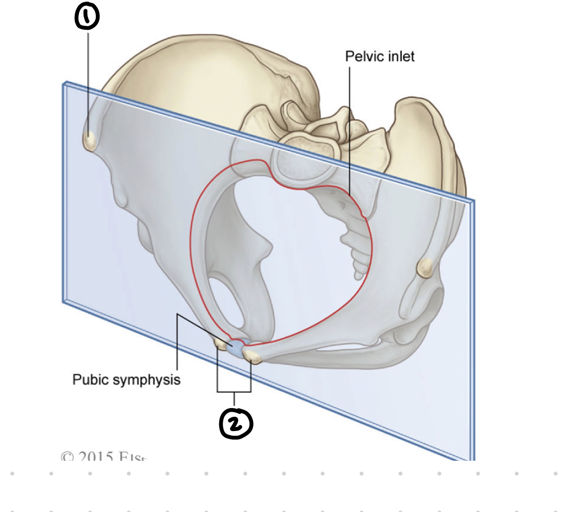 <p>pelvic girdle coronal plane - 1</p>