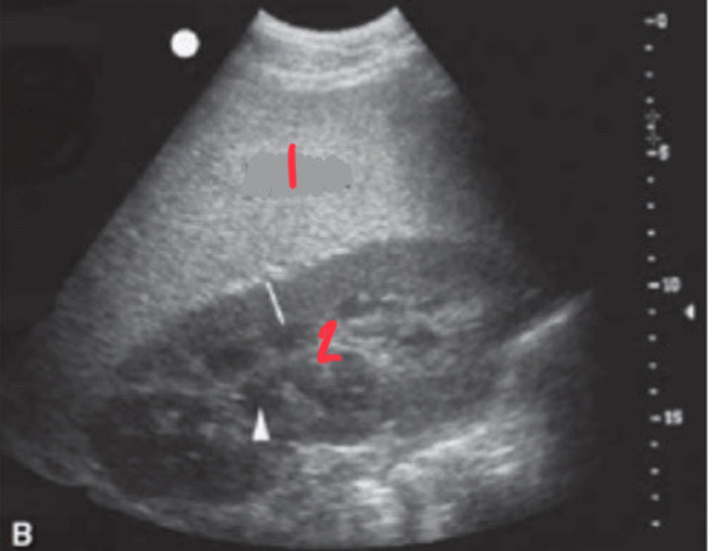 <p>What FLASH view is this in horses and what are the numbers showing you?</p>