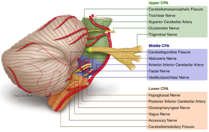 <p>constant positional vertigo + severe nausea with tinnitus; cerebellopontine angle</p>