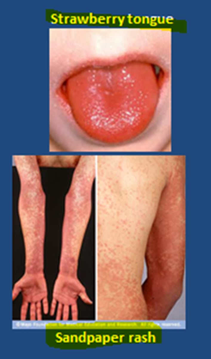 <p>strawberry tongue, bright red rash, pharyngitis</p>