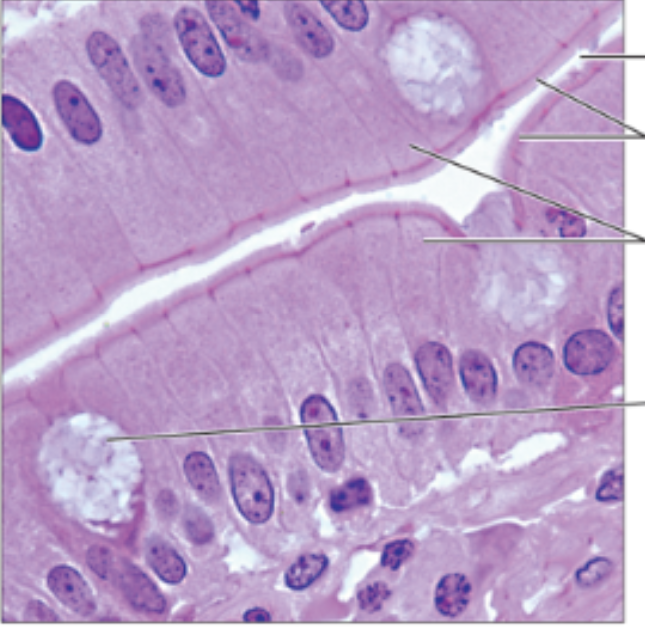 <p>(epithellial) rectanlgular, long cells with nuclei lined up</p>