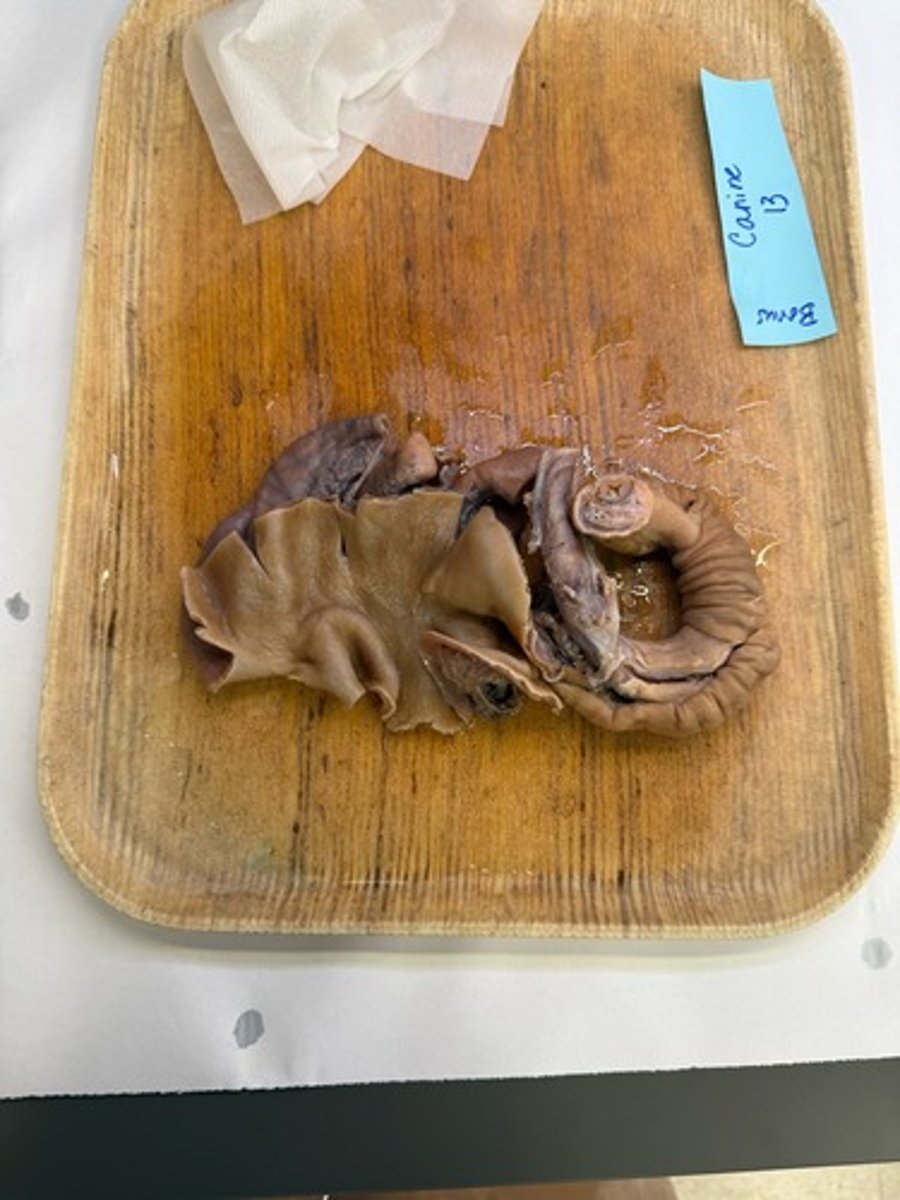 <p>What is this lesion?</p>