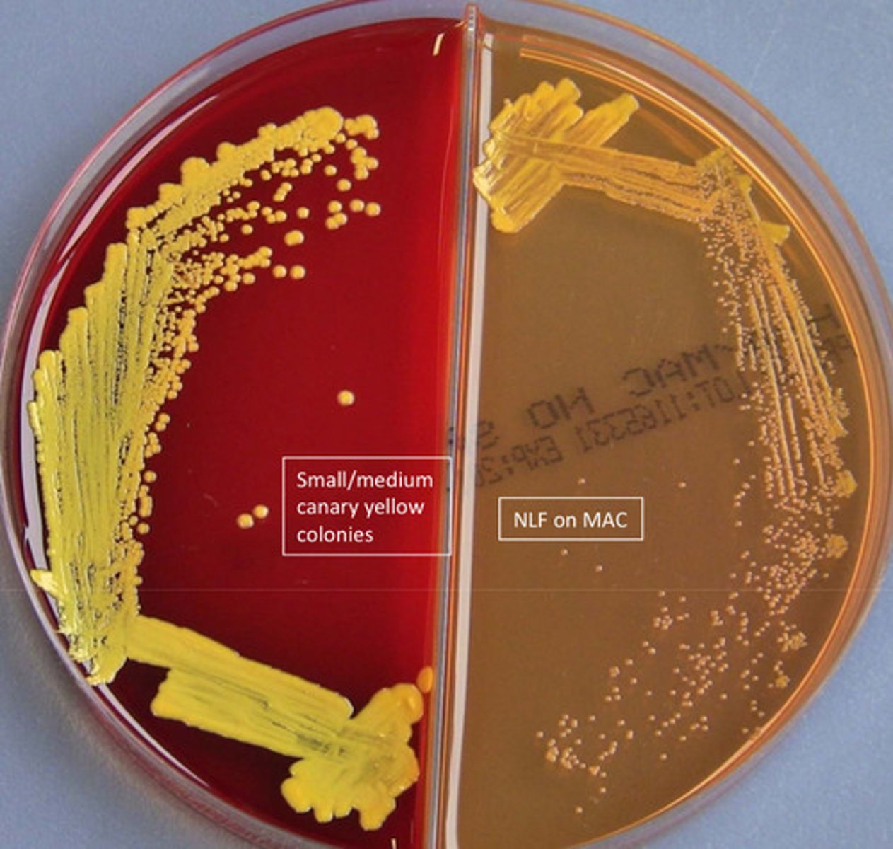 <p>cat pos GPC (larger than Staph), coagulase neg, obligate aerobe, microdase pos</p>