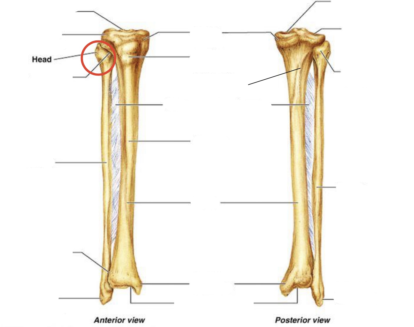 <p><span><span>Head of fibula</span></span></p>