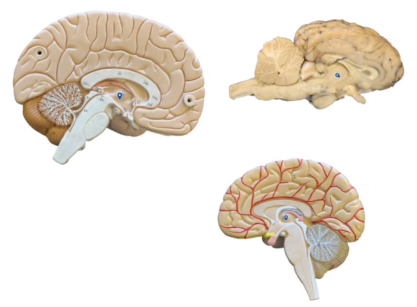 <p>What structure is the arrow pointing to?</p>