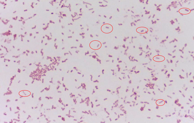 <p>What bacteria is this?</p>