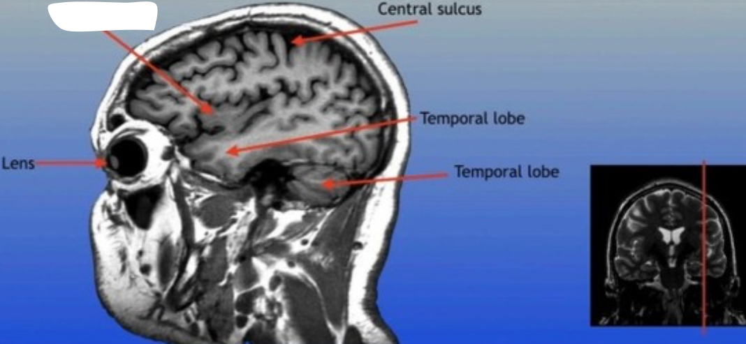 <p>Region of the brain located deep within the lateral sulcus, involved in functions such as emotion processing and self-awareness. </p>