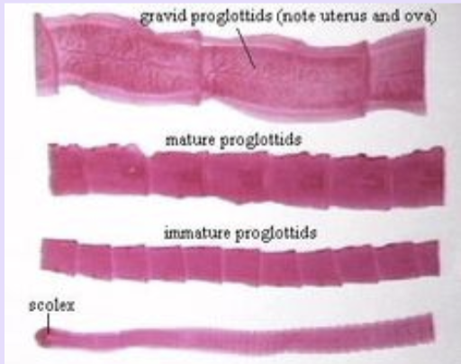 cestoidea (tapeworms)
