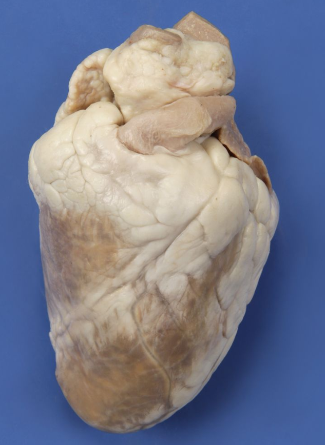 <p>What view of the sheep heart is this?</p>