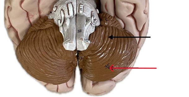 <p>Which part of the cerebellum is:</p><ul><li><p>Back/rear lobe of cerebellum</p></li></ul><p></p>