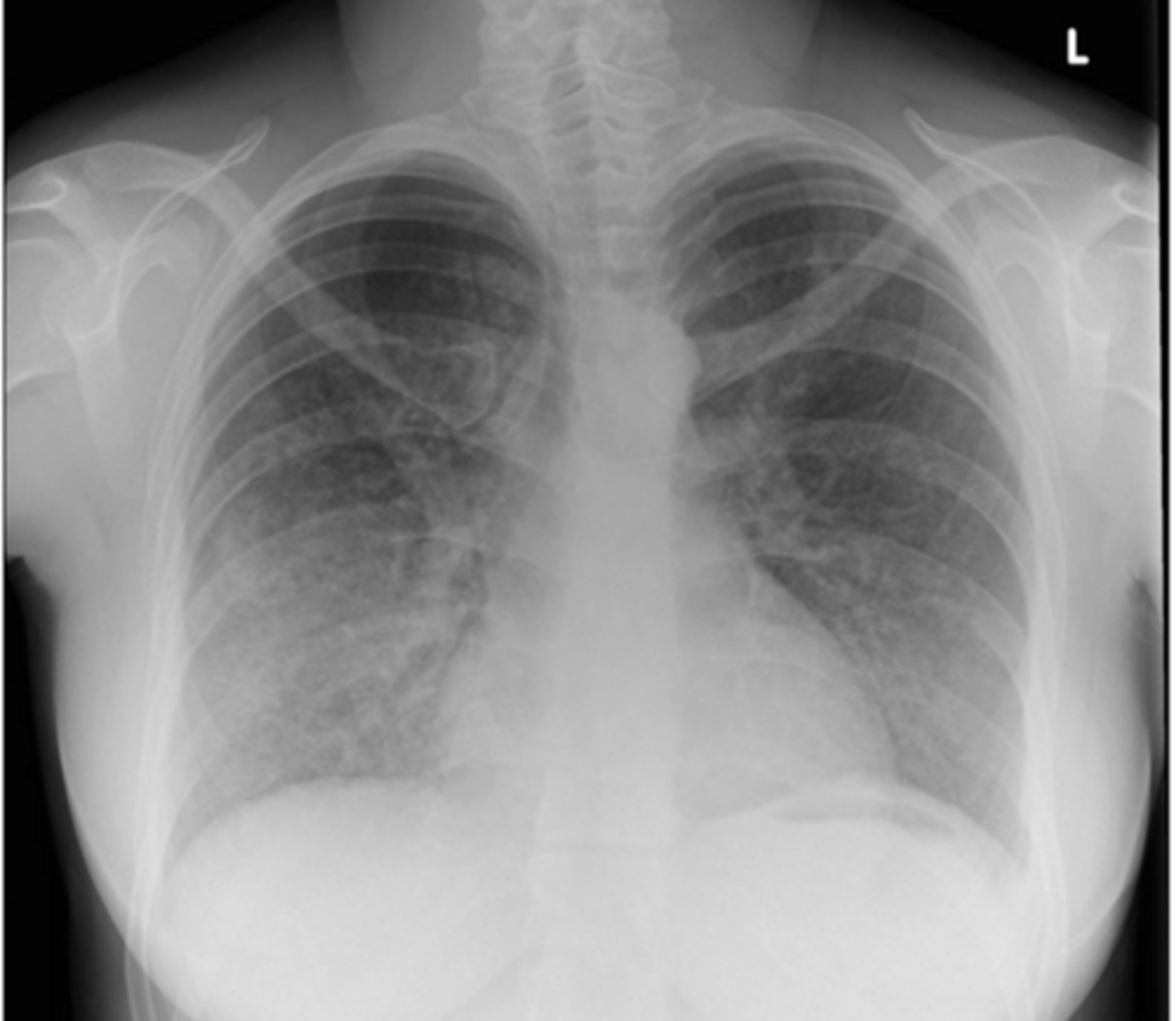 <p>Name the condition</p>