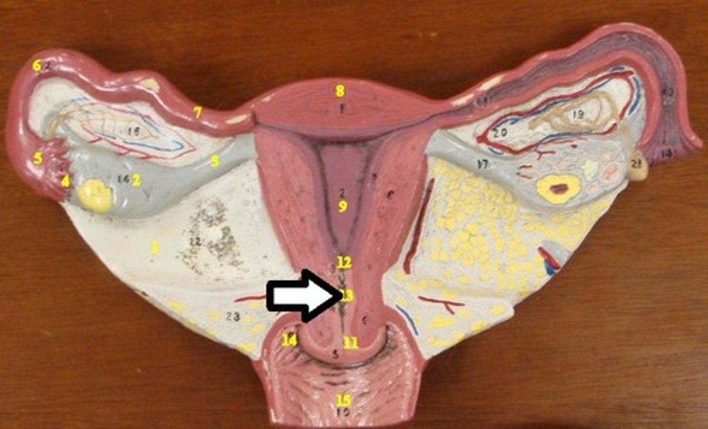 <p>connects uterus and cervix</p>