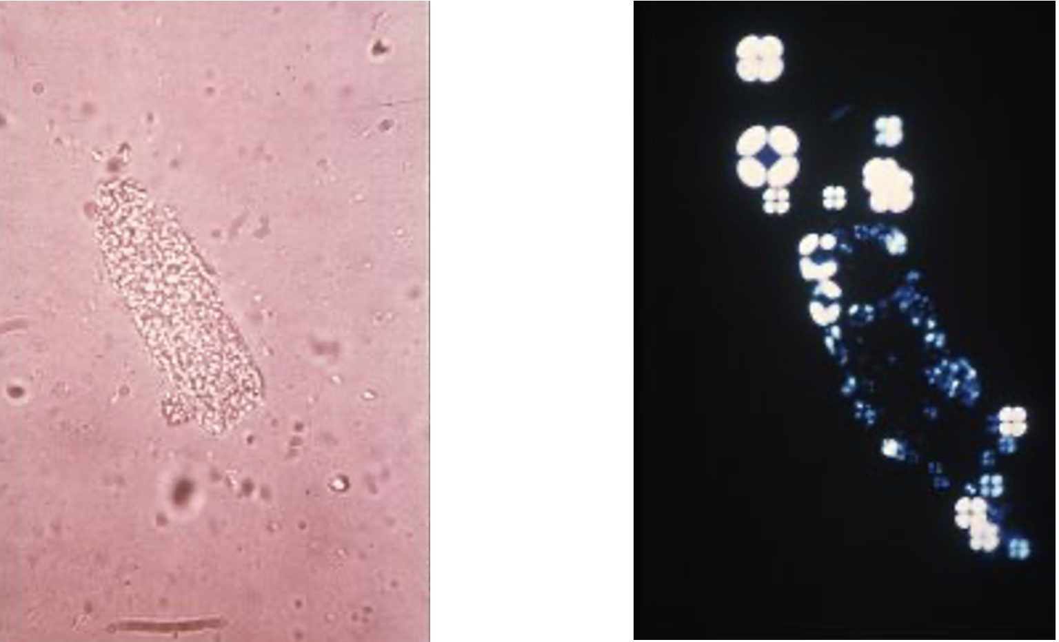 <p>What pathology is indicated?</p>