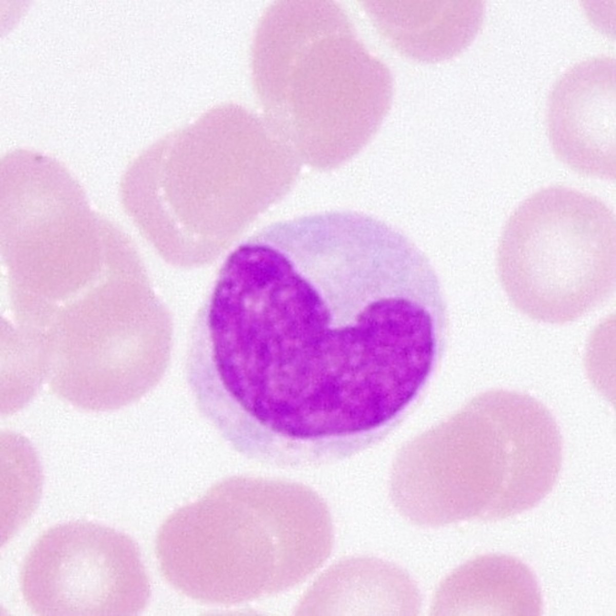<p>stain lavender; looks fuzzy because of lack of granules; very large; kidney bean/horse-shoe nucleus; 3-8%</p>