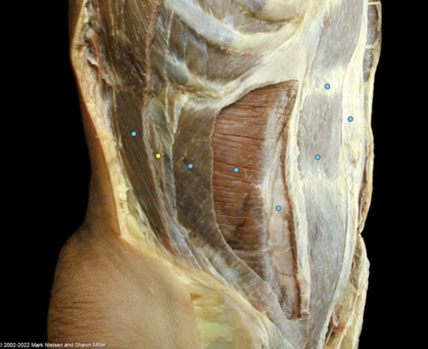 knowt flashcard image