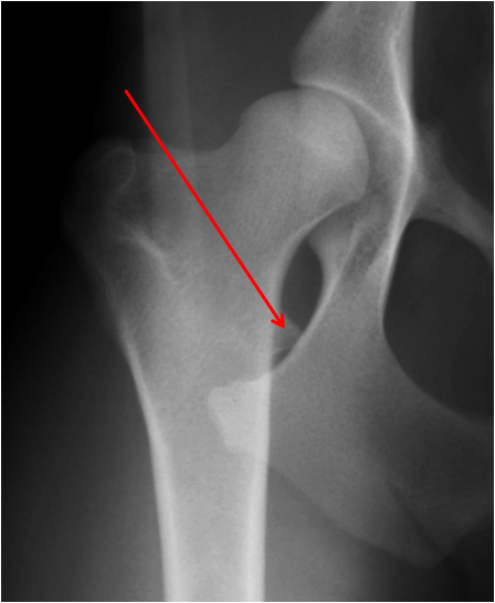 <p>identify this structure</p>