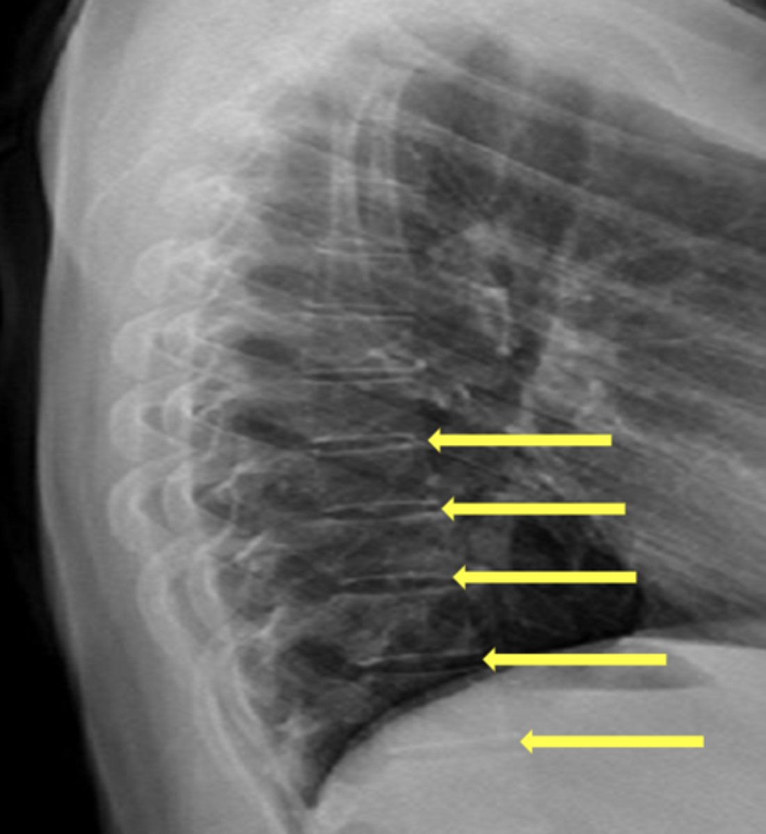 <p>What are the yellow arrows pointing to?</p>