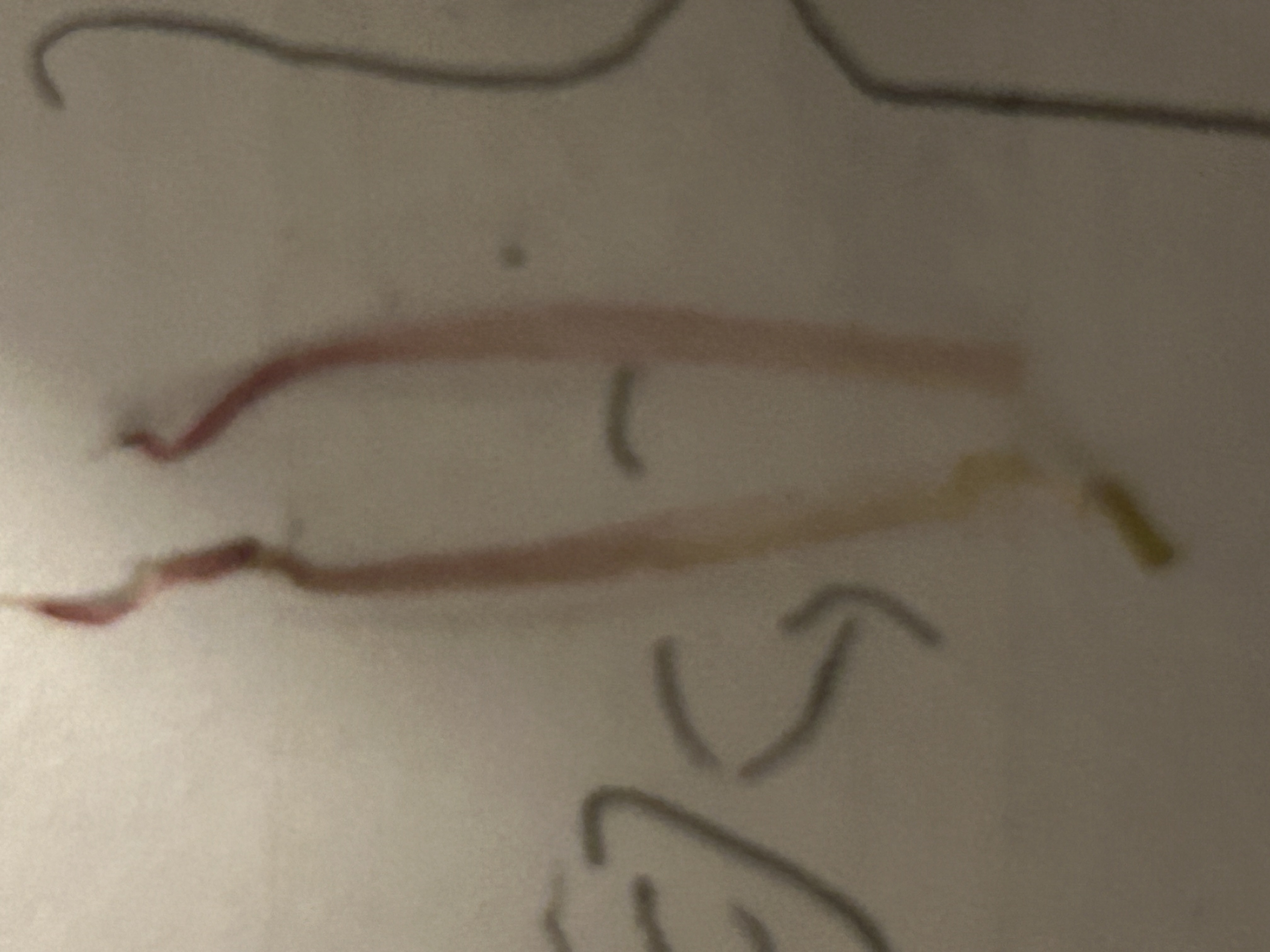 <p>A stalk that supports the anther, attaching it to the receptacle of the flower.</p>