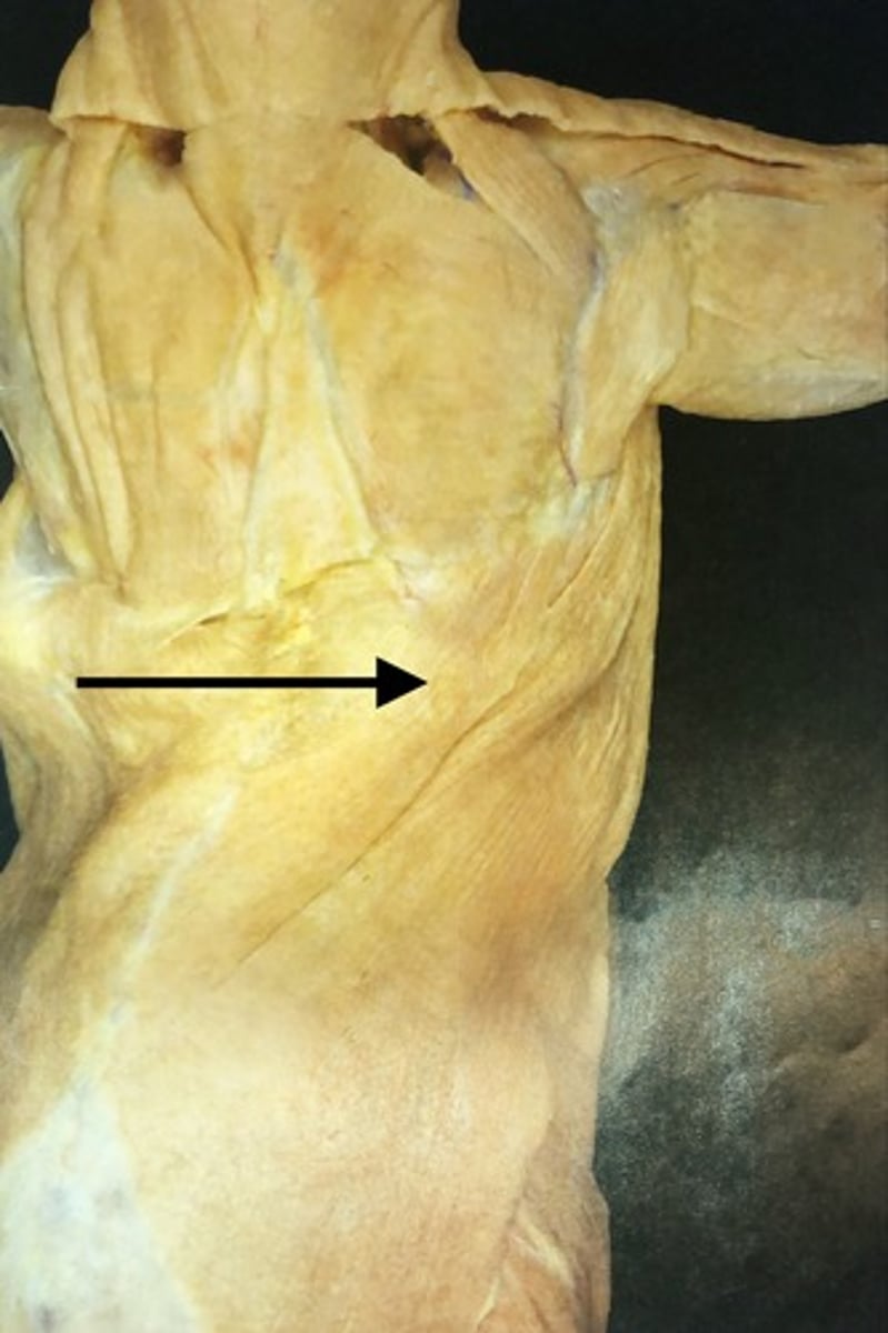 <p>name this muscle</p>