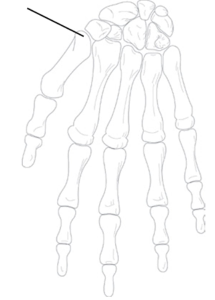 <p>What is the name of this joint based off of the shape of the articulating bones?</p>