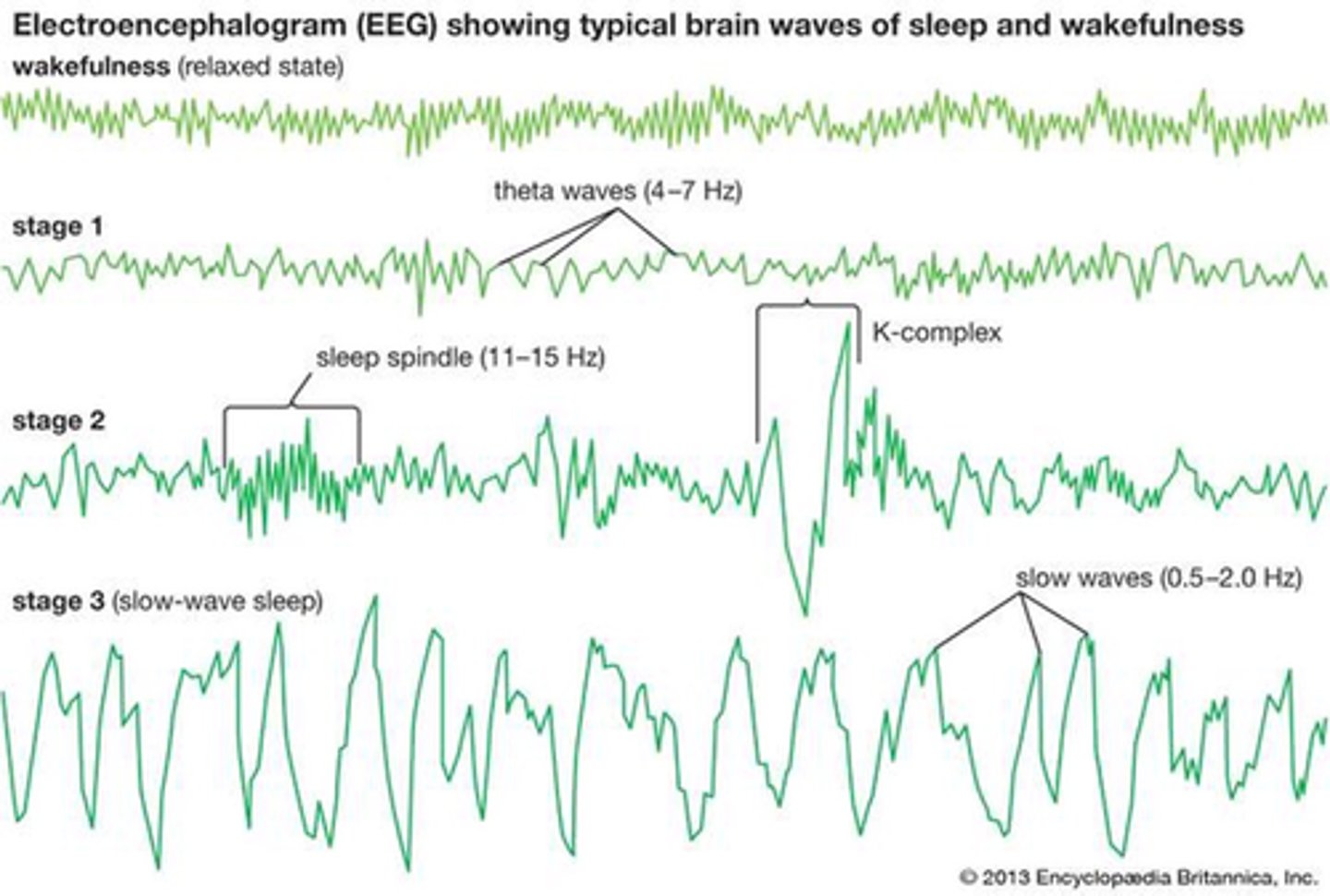 <p>Stages of non-REM sleep compared</p>