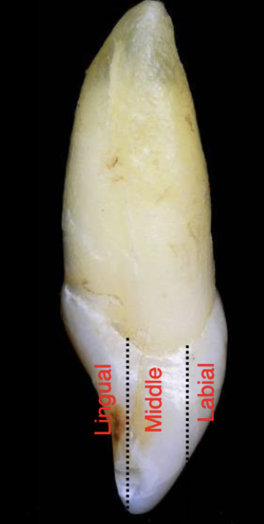 <p>lingual, middle, labial/buccal</p>