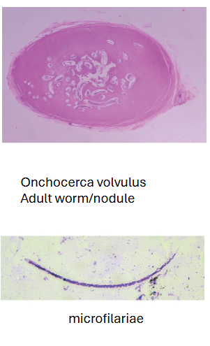 <p>What are morphology features of Onchocerca microfilariae?</p>