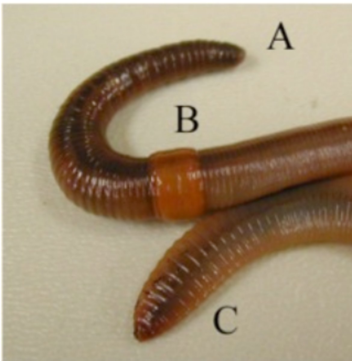 <p>What is this photo pointing to? (b)</p>