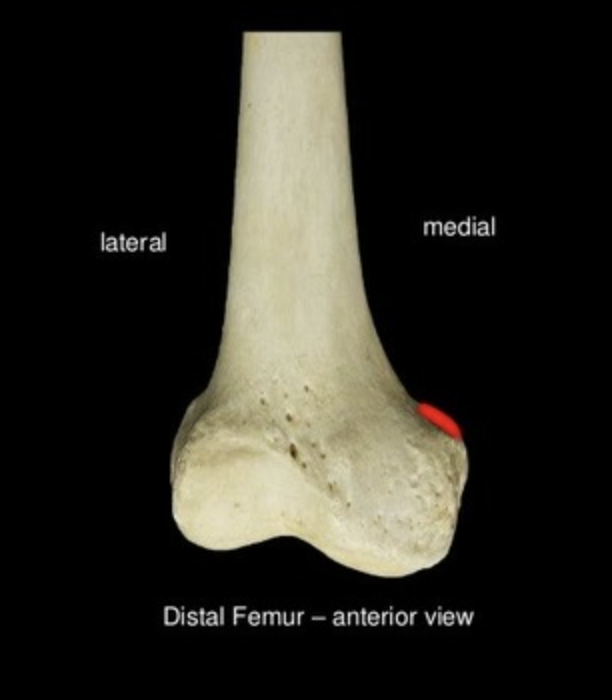 <p>bumpy point on the medial epicondyle, could be chipped on real bone</p>