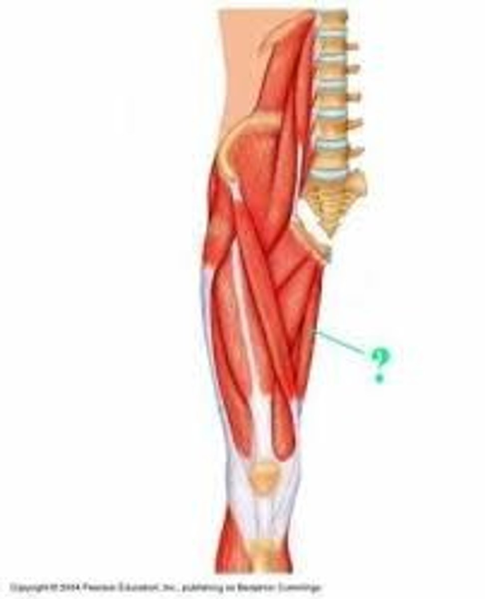 <p>Identify the indicated muscle.</p>