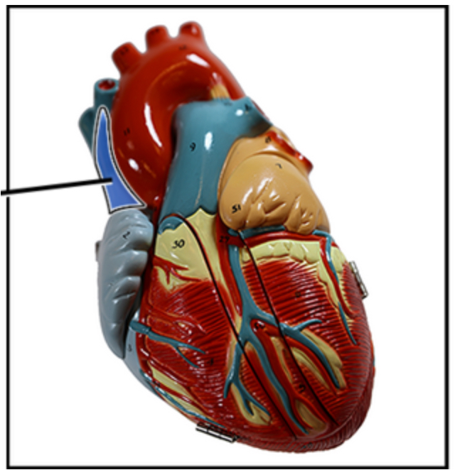 <p>Name this vein.</p>
