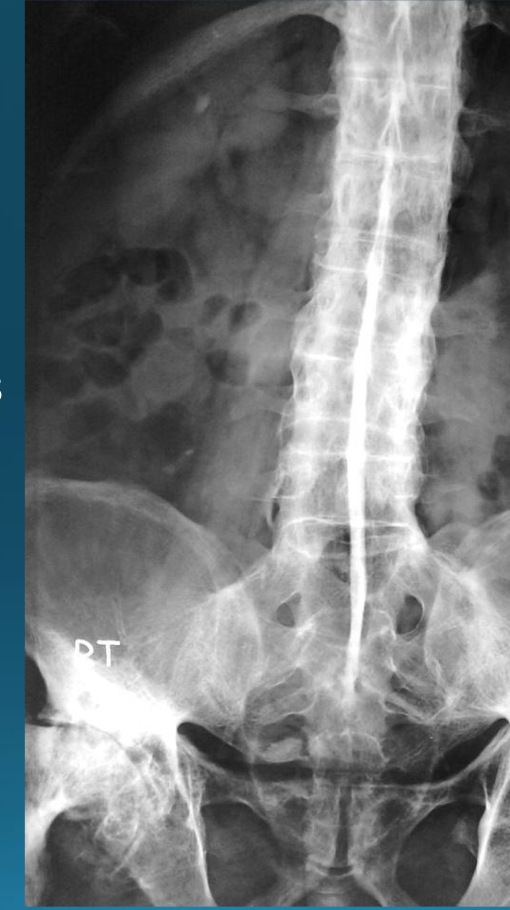 <p>what do you call this sign? what diangosis is this apart of? </p>