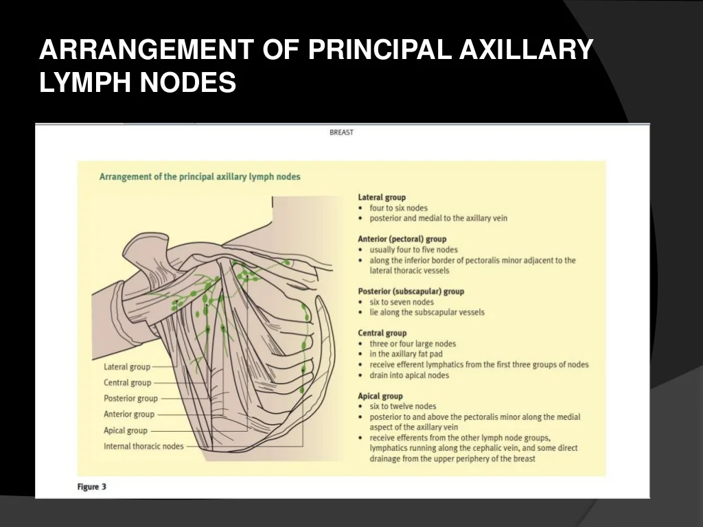 <p>In lymphatic drainage of the breast, the major portion (about 75%) enters eventually into which group of nodes?</p><p><strong><mark data-color="red" style="background-color: red; color: inherit">A. Central axillary</mark></strong></p><ul><li><p>About 75% of the lymph from the breast drains into the <strong>central axillary lymph nodes</strong>, which then drain into the apical nodes and further into the subclavian lymphatic trunk</p></li></ul><p>B. Deltopectoral</p><p>C. Lateral axillary</p><p>D. Parasternal</p><p>E. Subscapular</p><p></p><p><mark data-color="purple" style="background-color: purple; color: inherit">BUT ALSO PECTORAL AXILLARY</mark></p><ul><li><p><strong>Pectoral (anterior) axillary nodes</strong> = first stop for lymph from the breast.</p></li><li><p><strong>Central axillary nodes</strong> = major collecting nodes receiving lymph from pectoral and other axillary groups</p></li></ul><p>Here’s the typical flow:</p><ul><li><p>Lymph from the breast first drains into <strong>pectoral (anterior) axillary nodes</strong>.</p></li><li><p>Then, lymph passes to the <strong>central axillary nodes</strong>.</p></li><li><p>Finally, it drains into the apical (subclavian) nodes.</p></li></ul><p></p><p></p>