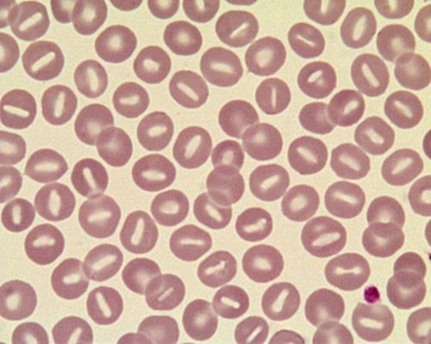 <p>stomatocyte</p>