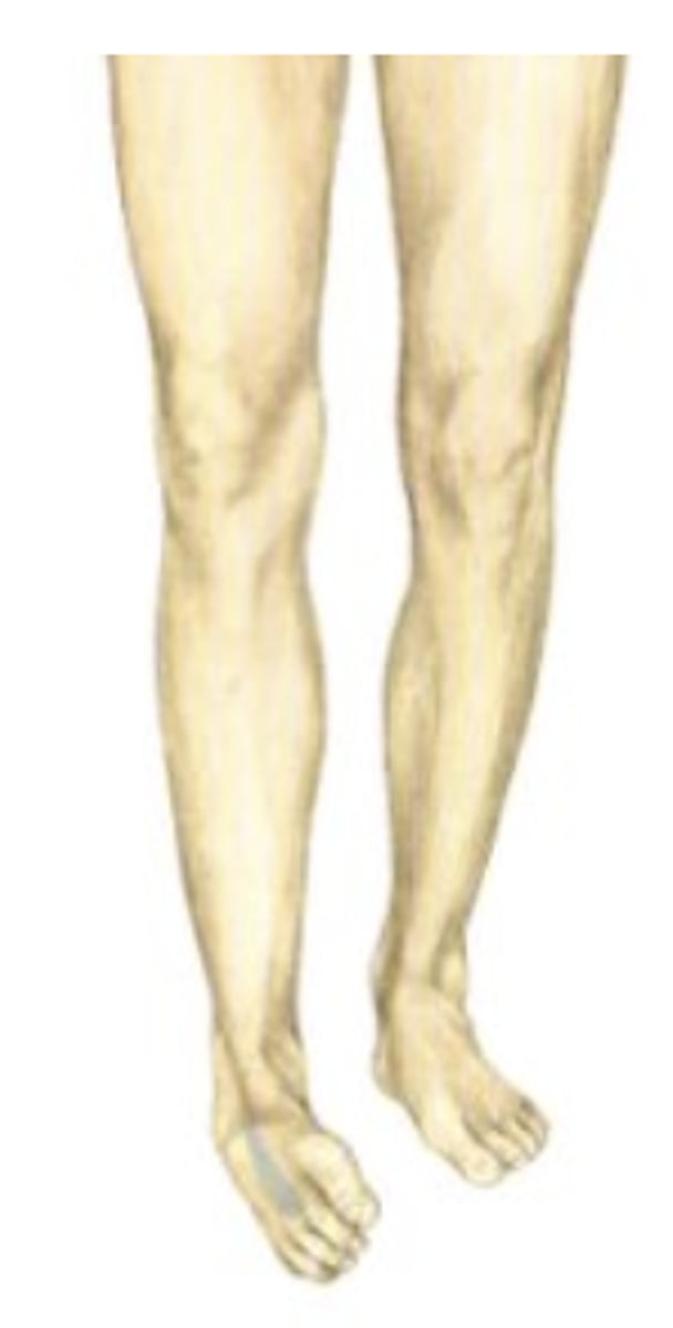 <p>Lateral leg</p><p>Superficial fibular n.</p><p>-Ankle everters help transition weight medially onto ball of foot for toe-off. Also help foot adapt to uneven surfaces. Weak ankle everters or superficial fibular nerve damage can result in walking on the lateral side of the foot</p><p>--&gt;Tension in from inverters overpowers, pulls foot into inversion</p>