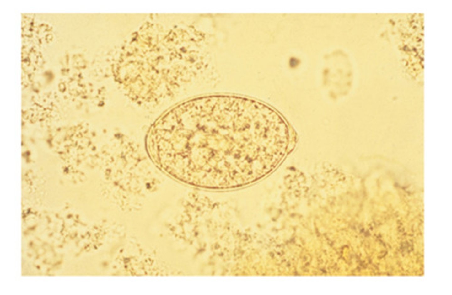 <p>ID this ovum of a cotyloda tapeworm that has an operculated ovum with an oval shape and yellowish brown color</p>