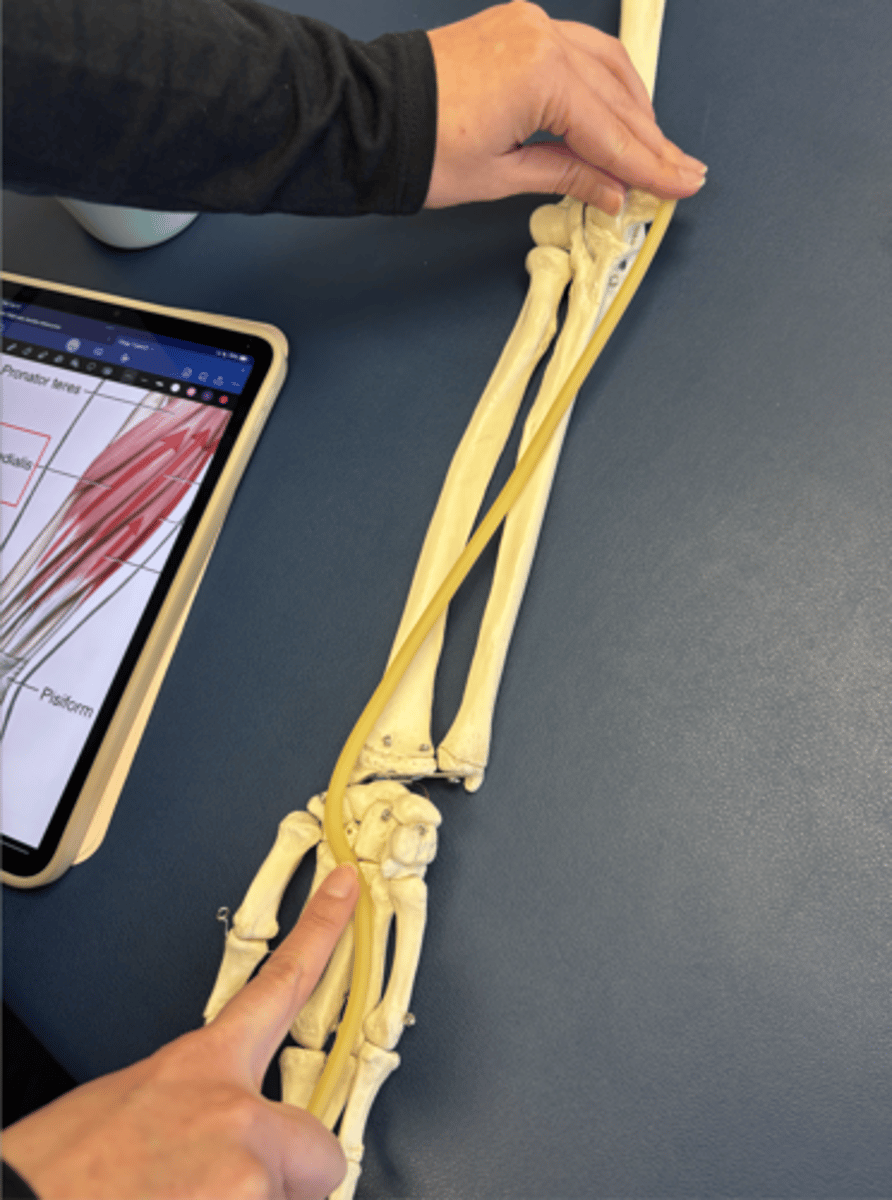 <p>What is this muscle?</p>