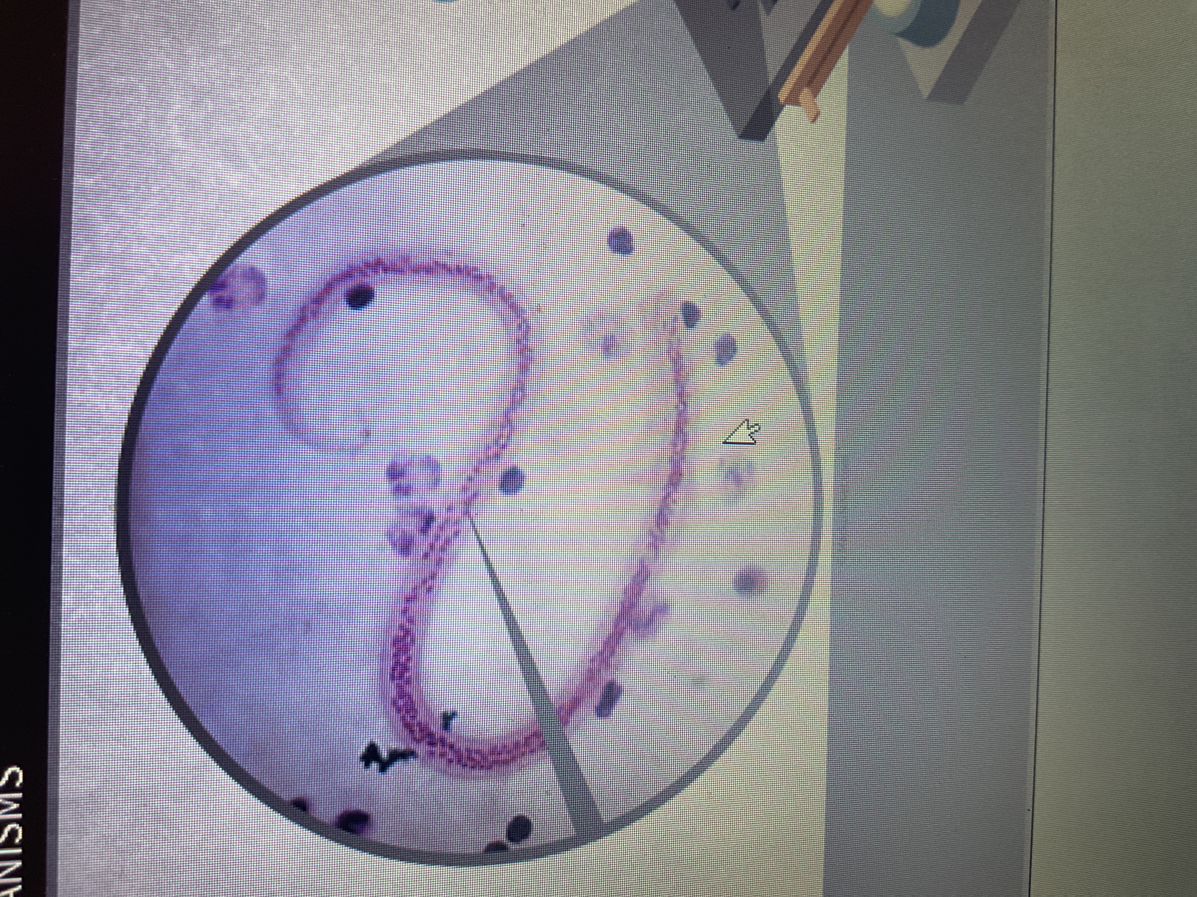 <p>Helminth</p><p>Threadlike worm infecting the lymph system from mosquitos</p>